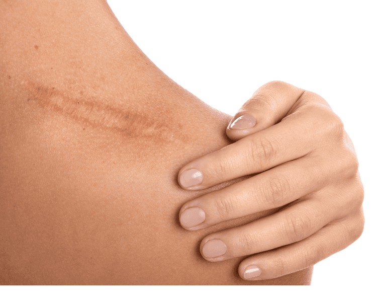 Imagem ilustrativa sobre Recuperação de Lesões